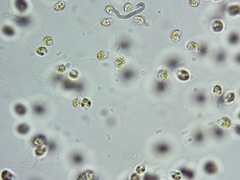 Uroglena