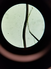 Ulothrix