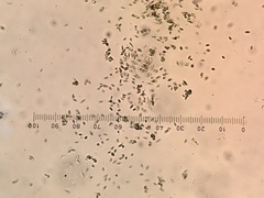 Chaenothecopsis