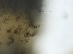 Stilbella fimetaria