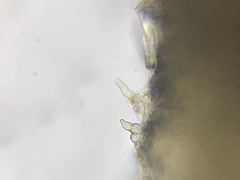 Stilbella fimetaria