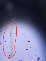 Fragilaria