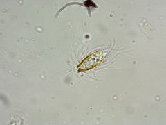 Mallomonas caudata