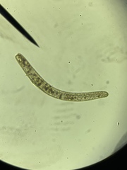 Spirostomum
