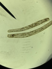 Spirostomum