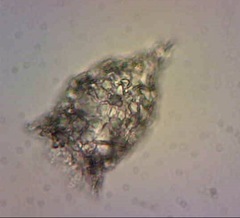 Codonella