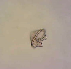 Protoperidinium