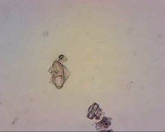 Protoperidinium