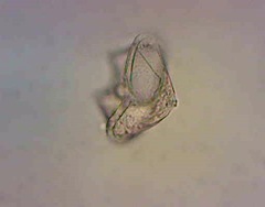Protoperidinium