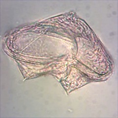 Protoperidinium