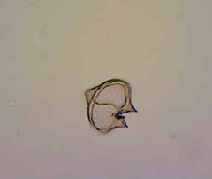 Protoperidinium