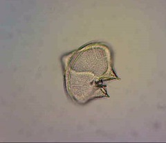 Protoperidinium