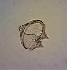 Protoperidinium
