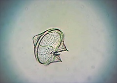 Protoperidinium