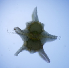 Annesorhiza macrocarpa
