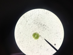 Micrasterias truncata