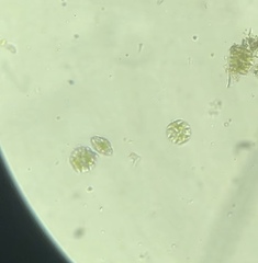 Micrasterias truncata