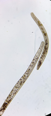 Spirostomum