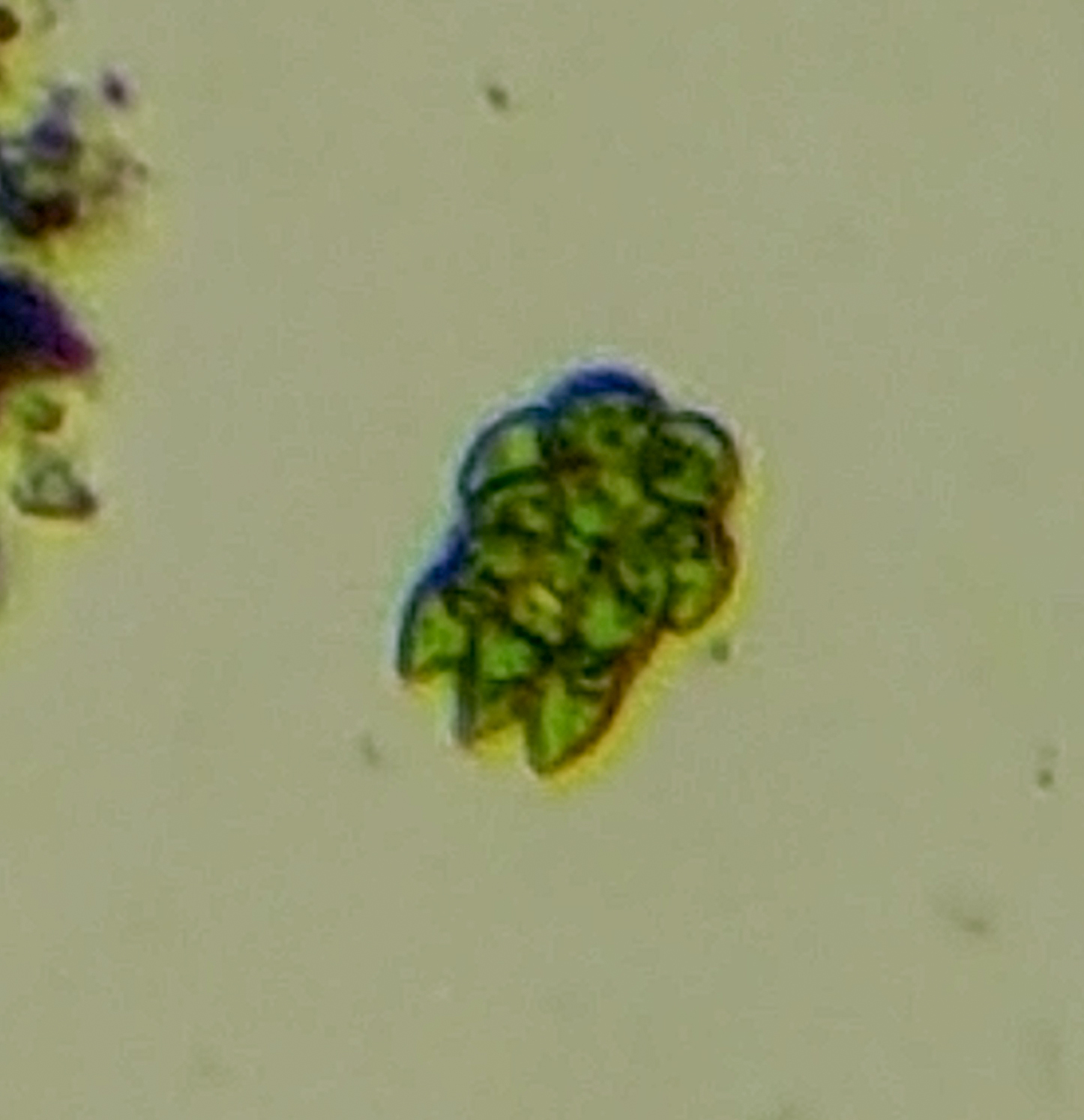 Spondylomorum