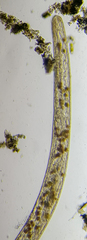 Spirostomum