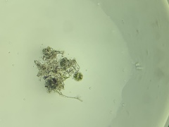 Micrasterias truncata