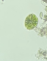 Micrasterias truncata