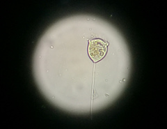 Vorticella campanula