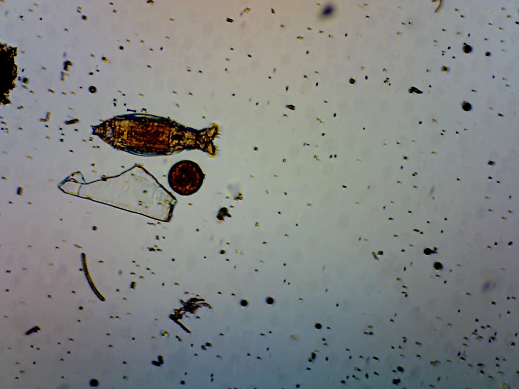 Macrotrachela quadricornifera