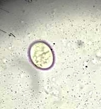 Entamoeba coli