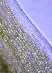 Dicranoloma dicarpum