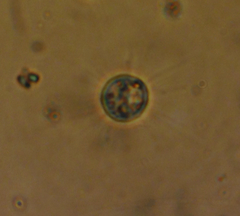 Heliozoa