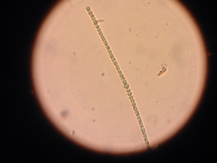 Anabaena