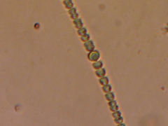 Anabaena