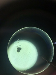 Vorticella campanula