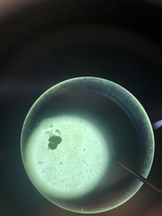 Vorticella campanula