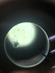 Vorticella campanula