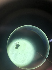 Vorticella campanula