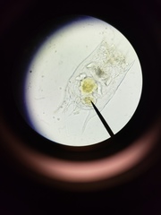 Brachionus calyciflorus