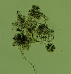 Micrasterias truncata