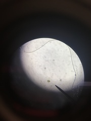 Micrasterias truncata