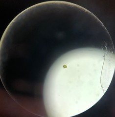 Micrasterias truncata