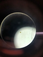 Micrasterias truncata