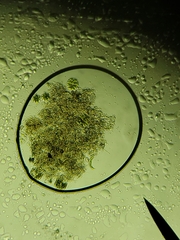 Micrasterias truncata