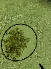 Micrasterias truncata