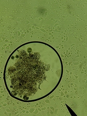 Micrasterias truncata