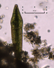 Closterium striolatum