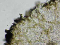 Intralichen baccisporus