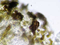 Intralichen baccisporus