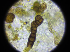 Intralichen baccisporus