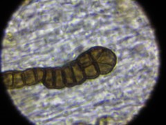 Intralichen baccisporus